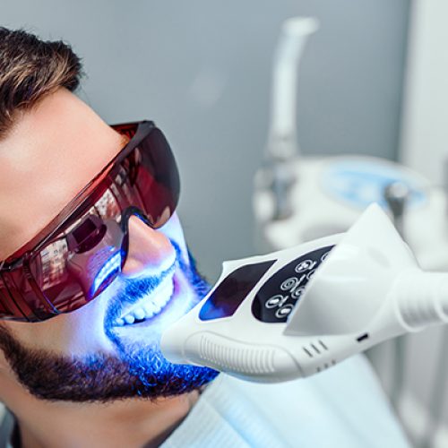 Teeth-Whitening